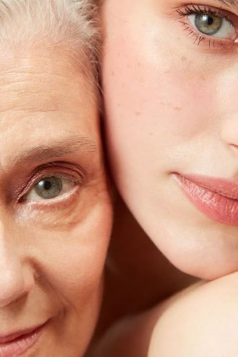 Can I Treat Acne and Aging at the Same Time? Yes — and Here’s How